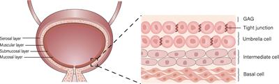 Current Researches on Nanodrug Delivery Systems in Bladder Cancer Intravesical Chemotherapy